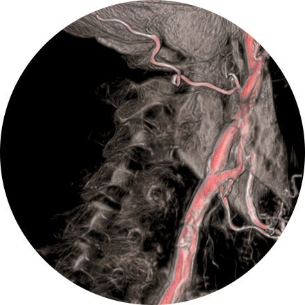 Interventional Radiology | RadNet Valley Radiology